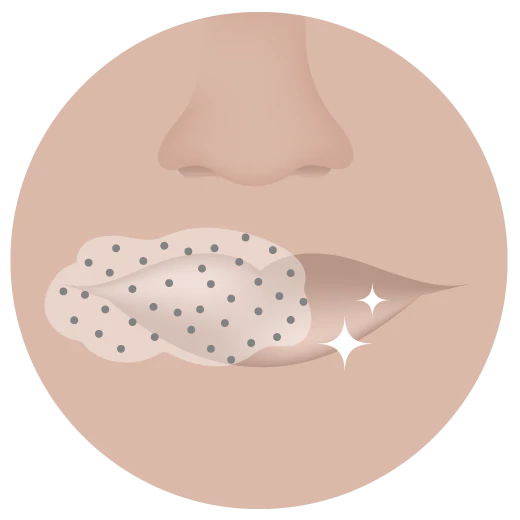 Illustration of the the nose and lips area with JuJu Bar applied to lips for exofilation.