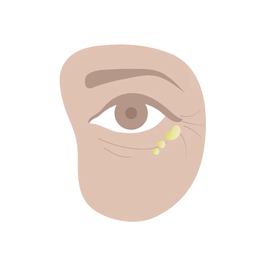 Illustration of Eye and Cheek area with a few drop of Virgin Marula Oil under the eye to help minimine the look of fine lines and rejuvenate the skin.