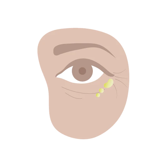 illustration showing where to apply Marula Oil under the eye